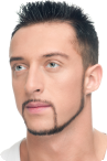 Prije face liftinga kod muškaraca Prije face liftinga kod muškaraca